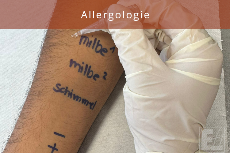 Allergologie hier kennenlernen